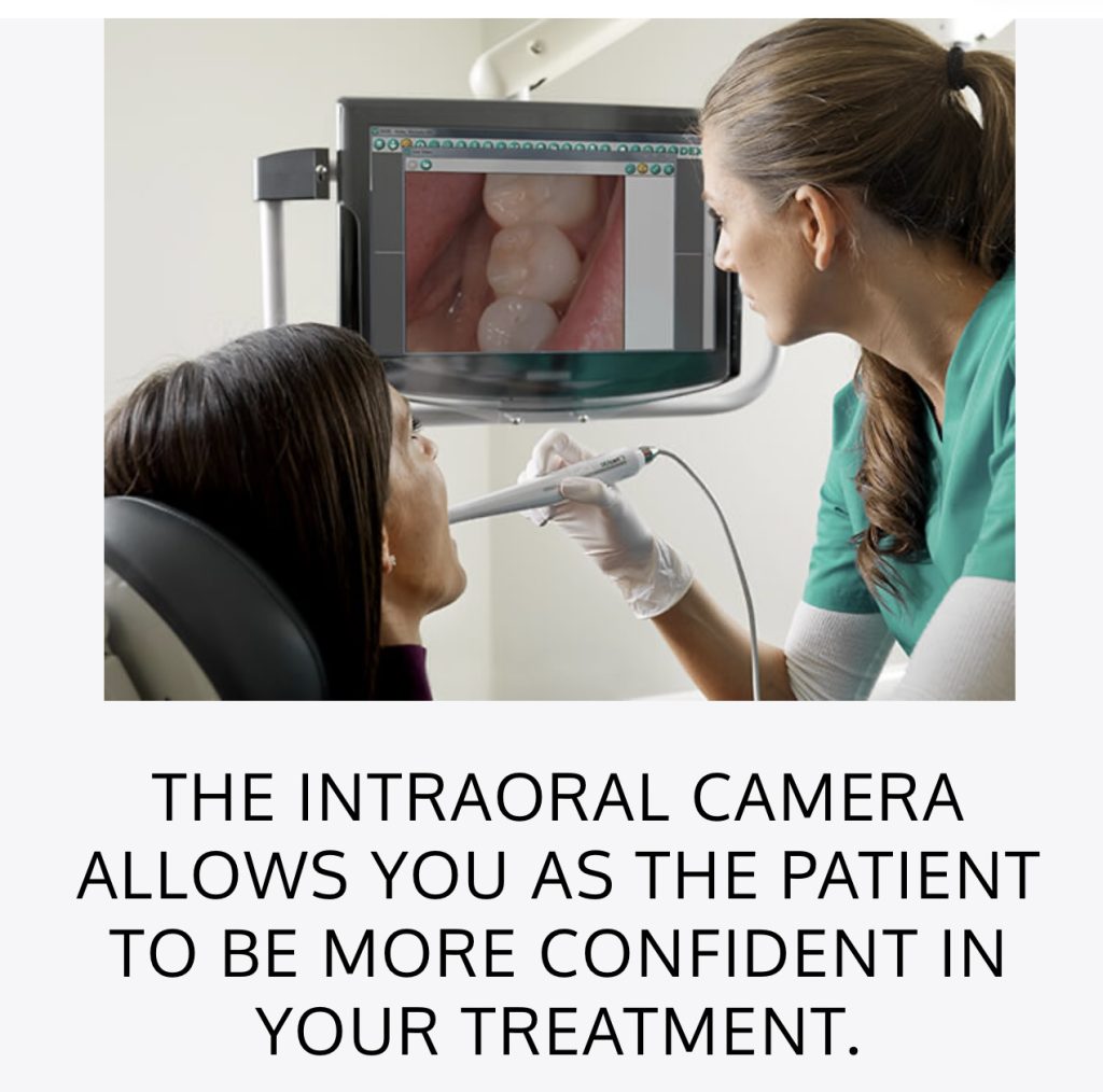 Intraoral Cameras – Nuevo Dental