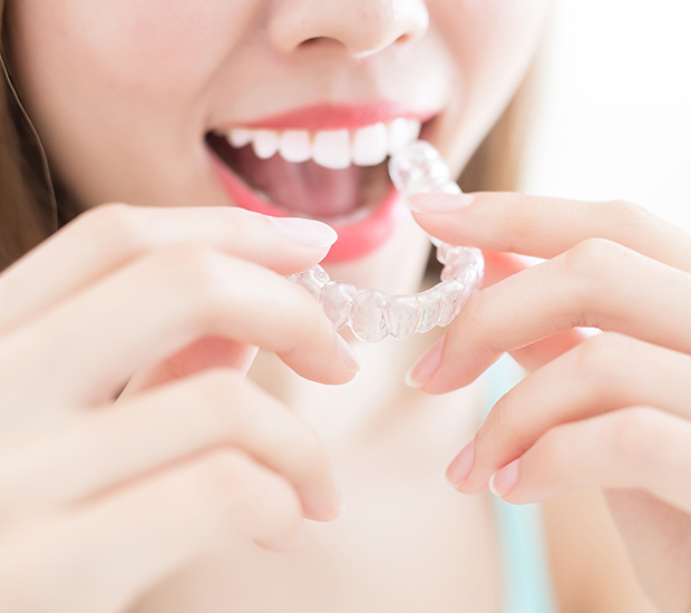 Invisalign Clear Aligners North Hollywood