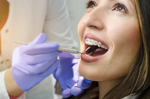 Metal Braces Clinic in North Hollywood